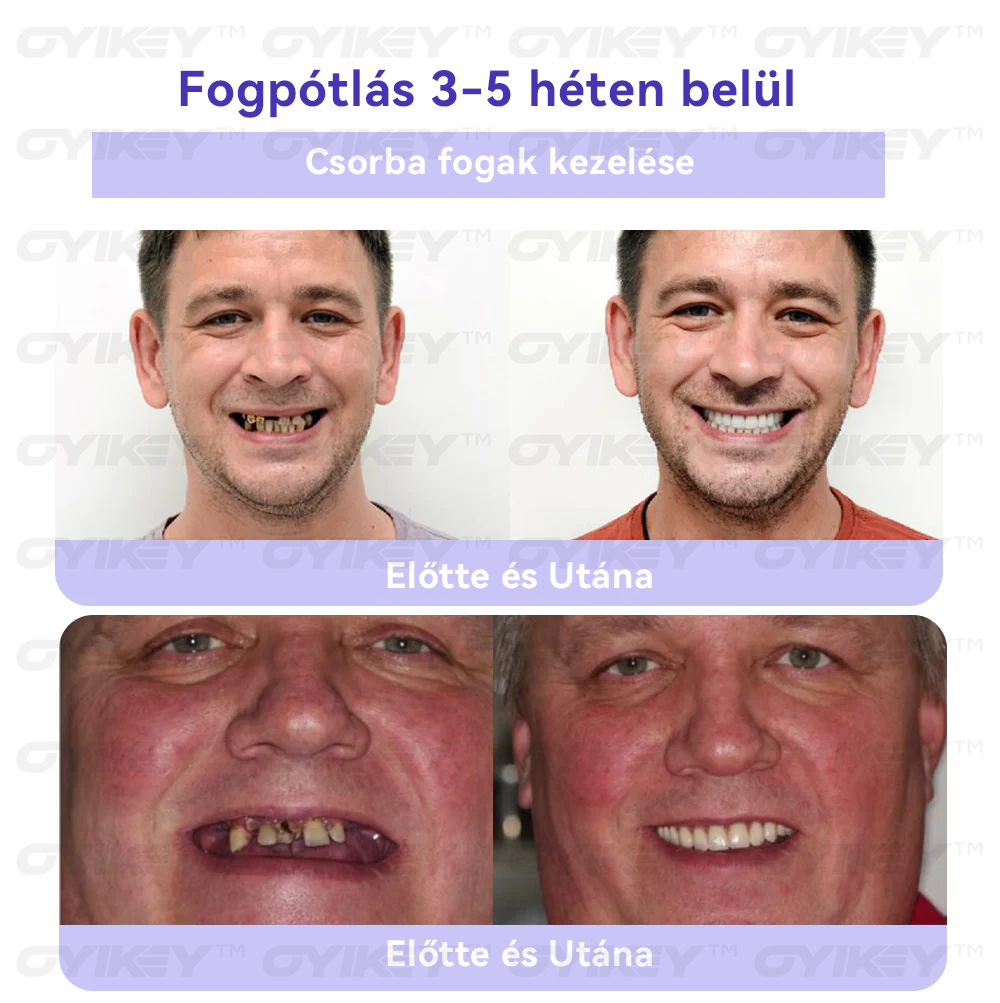 đŠđźđđČđąđ€đđČâą đ
đšđ đđ€ đđđ„đČđ«đĂĄđ„đ„ĂđĂĄđŹđ ĂđŹđŻĂĄđ§đČđą đđšđ«đ(MFK ajĂĄnlotta)