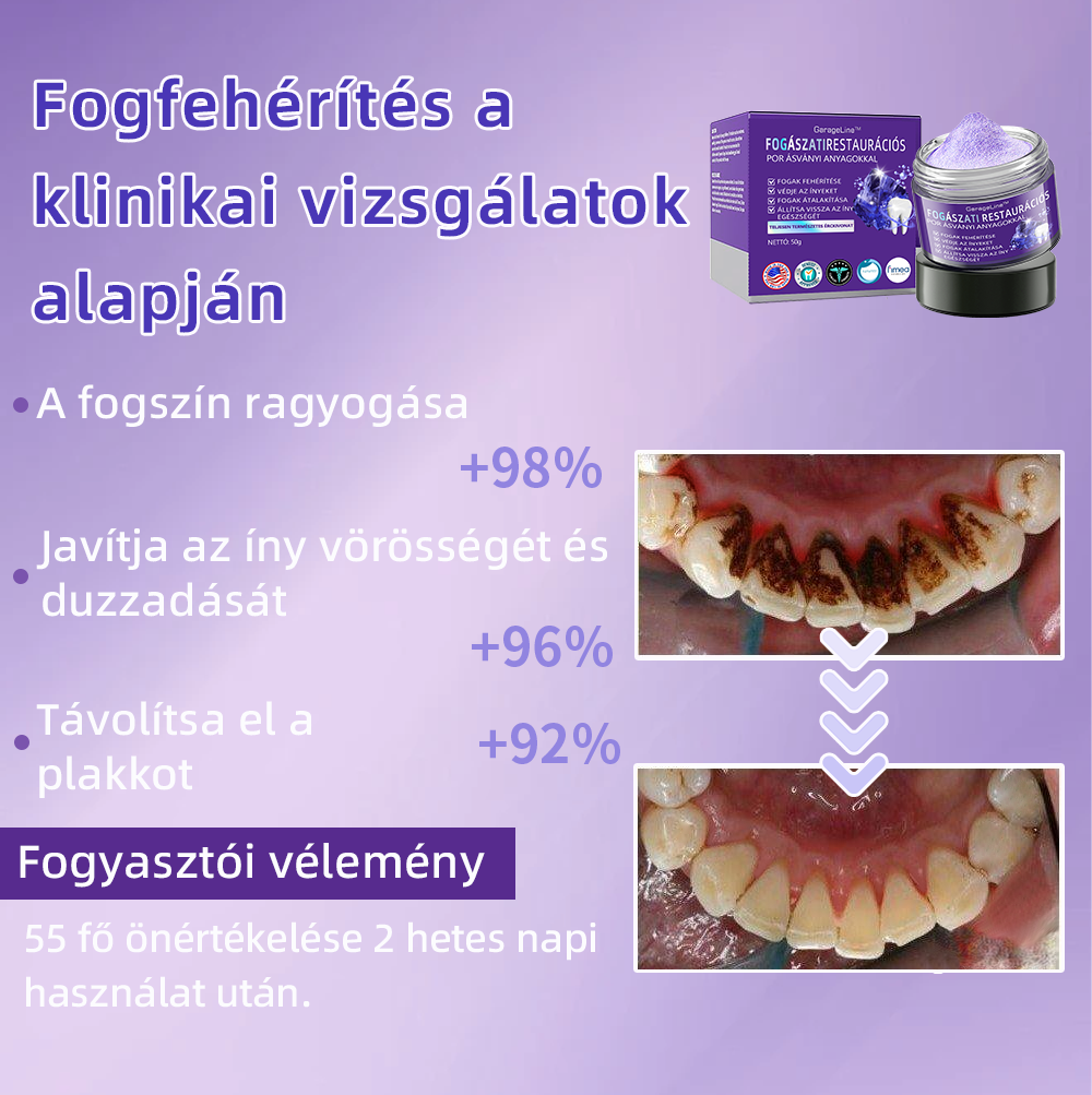 💜𝐆𝐚𝐫𝐚𝐠𝐞𝐋𝐢𝐧𝐞™ 👨‍⚕️(𝐀𝐃𝐄𝐄 𝐚𝐣á𝐧𝐥𝐨𝐭𝐭) 𝐅𝐨𝐠á𝐬𝐳𝐚𝐭𝐢 𝐫𝐞𝐬𝐭𝐚𝐮𝐫á𝐜𝐢ó𝐬 𝐩𝐨𝐫 á𝐬𝐯á𝐧𝐲𝐢 𝐚𝐧𝐲𝐚𝐠𝐨𝐤𝐤𝐚𝐥 (𝐊ü𝐥ö𝐧𝐥𝐞𝐠𝐞𝐬 𝐚𝐣á𝐧𝐥𝐚𝐭, 𝐮𝐭𝐨𝐥𝐬ó 𝟑𝟎 𝐩𝐞𝐫𝐜)💜
