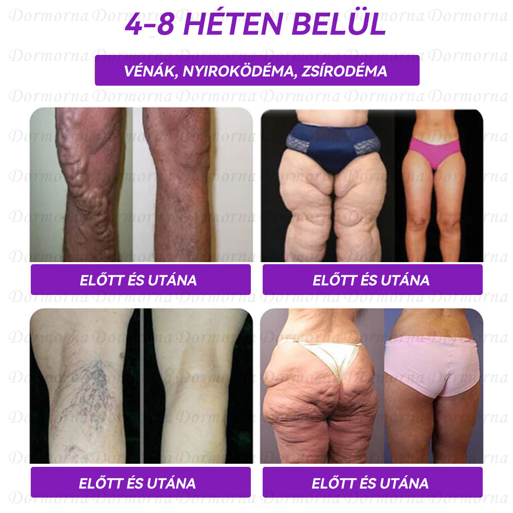 Semmelweis Egyetemi Kórház Ajánlott | Hivatalos áruház | 𝐃𝐨𝐫𝐦𝐨𝐫𝐧𝐚® 🔥 𝐆𝐋𝐏-𝟏 𝐎𝐫á𝐥𝐢𝐬 𝐟𝐨𝐥𝐲𝐚𝐝é𝐤--✅Forradalmi GLP-1 Tudományos Cukor Kontroll és Fogyókúra Programok