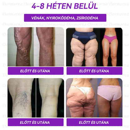 Semmelweis Egyetemi Kórház Ajánlott | Hivatalos áruház | 𝐃𝐨𝐫𝐦𝐨𝐫𝐧𝐚® 🔥 𝐆𝐋𝐏-𝟏 𝐎𝐫á𝐥𝐢𝐬 𝐟𝐨𝐥𝐲𝐚𝐝é𝐤--✅Forradalmi GLP-1 Tudományos Cukor Kontroll és Fogyókúra Programok
