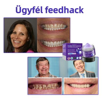 💜𝐆𝐚𝐫𝐚𝐠𝐞𝐋𝐢𝐧𝐞™ 👨‍⚕️(𝐀𝐃𝐄𝐄 𝐚𝐣á𝐧𝐥𝐨𝐭𝐭) 𝐅𝐨𝐠á𝐬𝐳𝐚𝐭𝐢 𝐫𝐞𝐬𝐭𝐚𝐮𝐫á𝐜𝐢ó𝐬 𝐩𝐨𝐫 á𝐬𝐯á𝐧𝐲𝐢 𝐚𝐧𝐲𝐚𝐠𝐨𝐤𝐤𝐚𝐥 (𝐊ü𝐥ö𝐧𝐥𝐞𝐠𝐞𝐬 𝐚𝐣á𝐧𝐥𝐚𝐭, 𝐮𝐭𝐨𝐥𝐬ó 𝟑𝟎 𝐩𝐞𝐫𝐜)💜