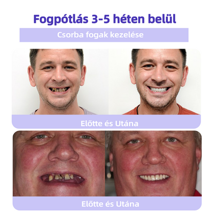 💜𝐆𝐚𝐫𝐚𝐠𝐞𝐋𝐢𝐧𝐞™ 👨‍⚕️(𝐀𝐃𝐄𝐄 𝐚𝐣á𝐧𝐥𝐨𝐭𝐭) 𝐅𝐨𝐠á𝐬𝐳𝐚𝐭𝐢 𝐫𝐞𝐬𝐭𝐚𝐮𝐫á𝐜𝐢ó𝐬 𝐩𝐨𝐫 á𝐬𝐯á𝐧𝐲𝐢 𝐚𝐧𝐲𝐚𝐠𝐨𝐤𝐤𝐚𝐥 (𝐊ü𝐥ö𝐧𝐥𝐞𝐠𝐞𝐬 𝐚𝐣á𝐧𝐥𝐚𝐭, 𝐮𝐭𝐨𝐥𝐬ó 𝟑𝟎 𝐩𝐞𝐫𝐜)💜