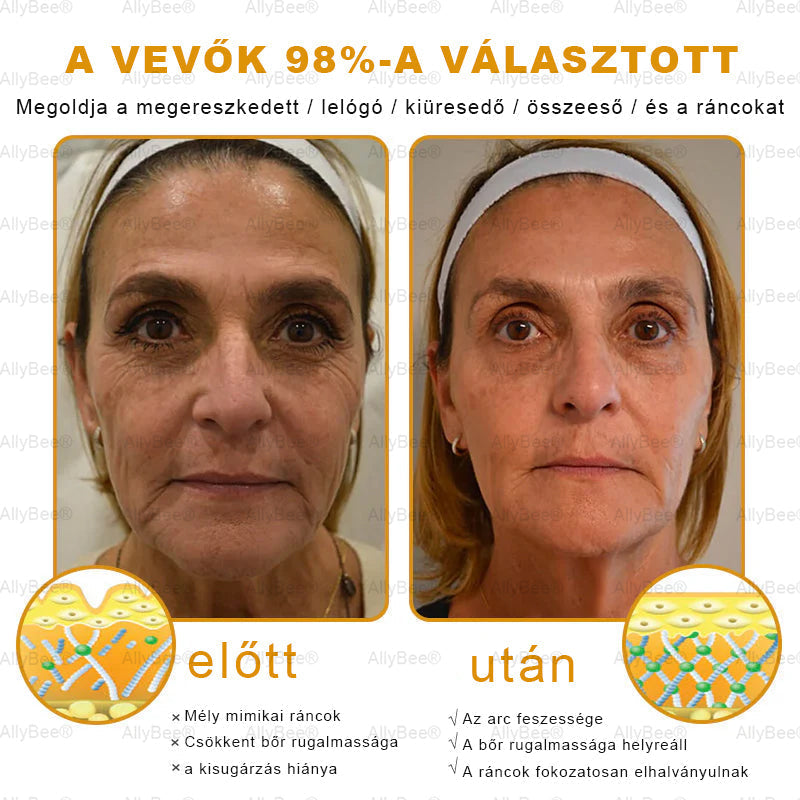 Spzv® bőrkezelő krém öregedésgátló, hidratáló, bőrjavító, egyenletes tónus, pattanások és sötét foltok kezelése, szemölcs és anyajegy eltávolítása, pikkelysömör enyhítése
