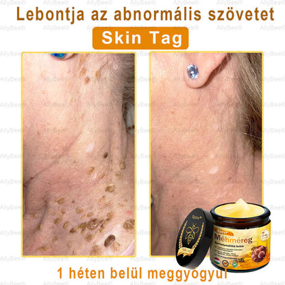 Spzv® bőrkezelő krém öregedésgátló, hidratáló, bőrjavító, egyenletes tónus, pattanások és sötét foltok kezelése, szemölcs és anyajegy eltávolítása, pikkelysömör enyhítése