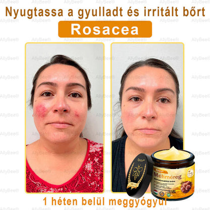 Spzv® bőrkezelő krém öregedésgátló, hidratáló, bőrjavító, egyenletes tónus, pattanások és sötét foltok kezelése, szemölcs és anyajegy eltávolítása, pikkelysömör enyhítése
