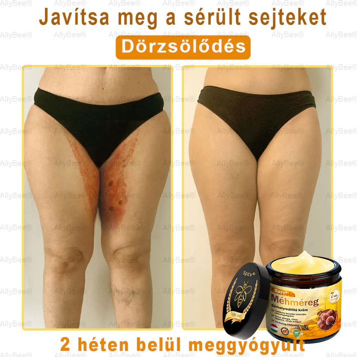 Spzv® bőrkezelő krém öregedésgátló, hidratáló, bőrjavító, egyenletes tónus, pattanások és sötét foltok kezelése, szemölcs és anyajegy eltávolítása, pikkelysömör enyhítése