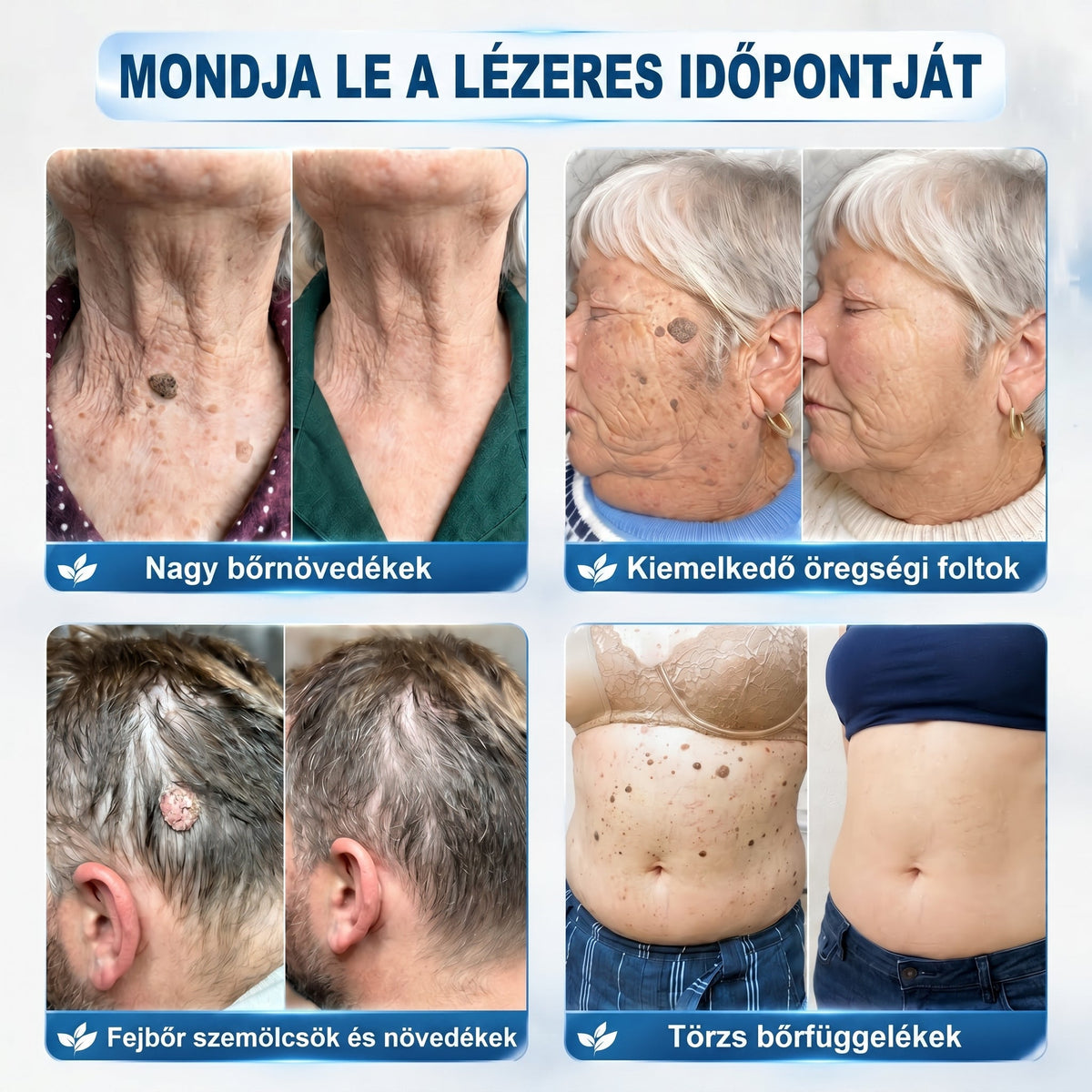 𝐏𝒊𝐜𝐝𝒐® 👩‍⚕️🎉7 𝑵𝒂𝒑𝒐𝒔 𝑩ö𝒓𝒌𝒊𝒏ö𝒗é𝒔- É𝒔 𝑭𝒐𝒍𝒕𝒆𝒍𝒕á𝒗𝒐𝒍í𝒕ó(𝐹á𝑗𝑑𝑎𝑙𝑜𝑚 𝑛é𝑙𝑘ü𝑙, ℎ𝑒𝑔𝑒𝑘 𝑛é𝑙𝑘ü𝑙 – 𝑟𝑜𝑙𝑙𝑒𝑟𝑏𝑎𝑙𝑙)