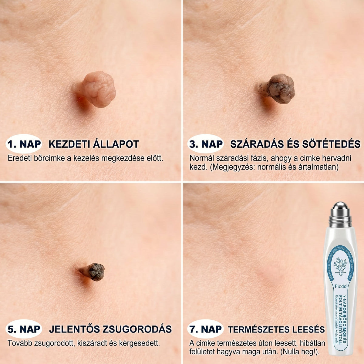 𝐏𝒊𝐜𝐝𝒐® 👩‍⚕️🎉7 𝑵𝒂𝒑𝒐𝒔 𝑩ö𝒓𝒌𝒊𝒏ö𝒗é𝒔- É𝒔 𝑭𝒐𝒍𝒕𝒆𝒍𝒕á𝒗𝒐𝒍í𝒕ó(𝐹á𝑗𝑑𝑎𝑙𝑜𝑚 𝑛é𝑙𝑘ü𝑙, ℎ𝑒𝑔𝑒𝑘 𝑛é𝑙𝑘ü𝑙 – 𝑟𝑜𝑙𝑙𝑒𝑟𝑏𝑎𝑙𝑙)