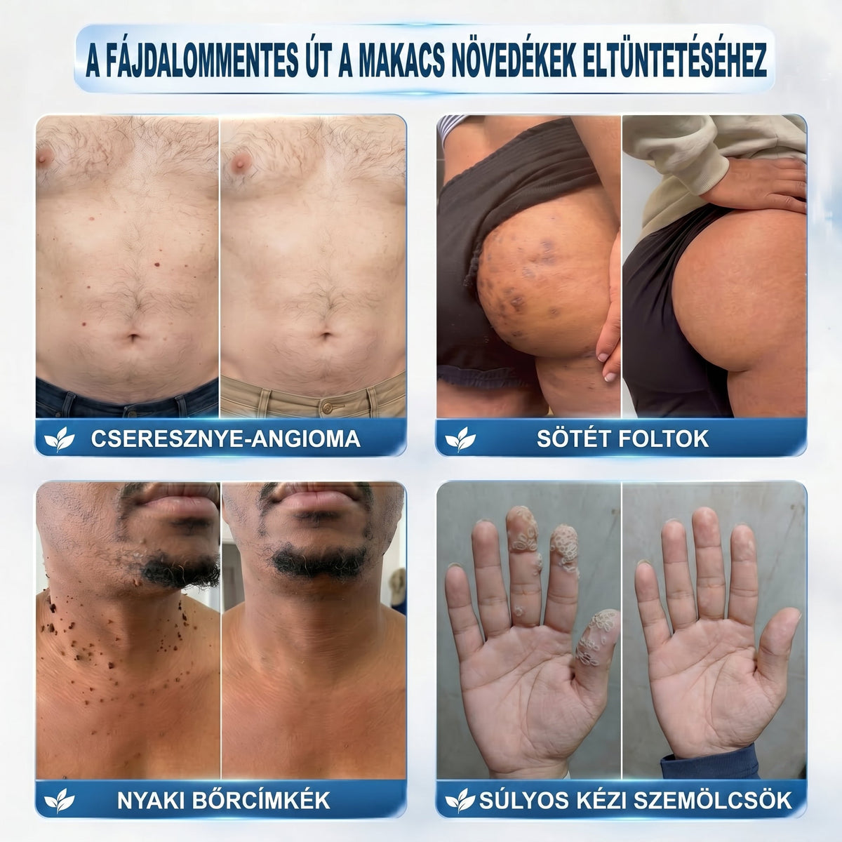 𝐏𝒊𝐜𝐝𝒐® 👩‍⚕️🎉7 𝑵𝒂𝒑𝒐𝒔 𝑩ö𝒓𝒌𝒊𝒏ö𝒗é𝒔- É𝒔 𝑭𝒐𝒍𝒕𝒆𝒍𝒕á𝒗𝒐𝒍í𝒕ó(𝐹á𝑗𝑑𝑎𝑙𝑜𝑚 𝑛é𝑙𝑘ü𝑙, ℎ𝑒𝑔𝑒𝑘 𝑛é𝑙𝑘ü𝑙 – 𝑟𝑜𝑙𝑙𝑒𝑟𝑏𝑎𝑙𝑙)