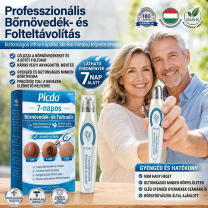 𝐏𝒊𝐜𝐝𝒐® 👩‍⚕️🎉7 𝑵𝒂𝒑𝒐𝒔 𝑩ö𝒓𝒌𝒊𝒏ö𝒗é𝒔- É𝒔 𝑭𝒐𝒍𝒕𝒆𝒍𝒕á𝒗𝒐𝒍í𝒕ó(𝐹á𝑗𝑑𝑎𝑙𝑜𝑚 𝑛é𝑙𝑘ü𝑙, ℎ𝑒𝑔𝑒𝑘 𝑛é𝑙𝑘ü𝑙 – 𝑟𝑜𝑙𝑙𝑒𝑟𝑏𝑎𝑙𝑙)