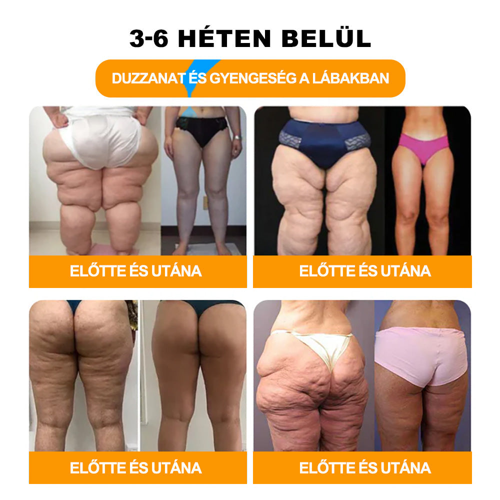 🚚📦Utolsó nap, hogy 70% KI: Tnnedey® 𝑴é𝒉𝒎é𝒓𝒆𝒈 é𝒔 30 𝒈𝒚ó𝒈𝒚𝒏ö𝒗é𝒏𝒚 𝒅𝒆𝒕𝒐𝒙 𝒍á𝒃𝒇ü𝒓𝒅ő 𝒈𝒚ö𝒏𝒈𝒚ö𝒌 𝒂 𝒕𝒆𝒔𝒕𝒇𝒐𝒓𝒎á𝒍á𝒔𝒉𝒐𝒛- Az Amerikai Nyirokgyógyászati Akadémia (ALA) ajánlása.
