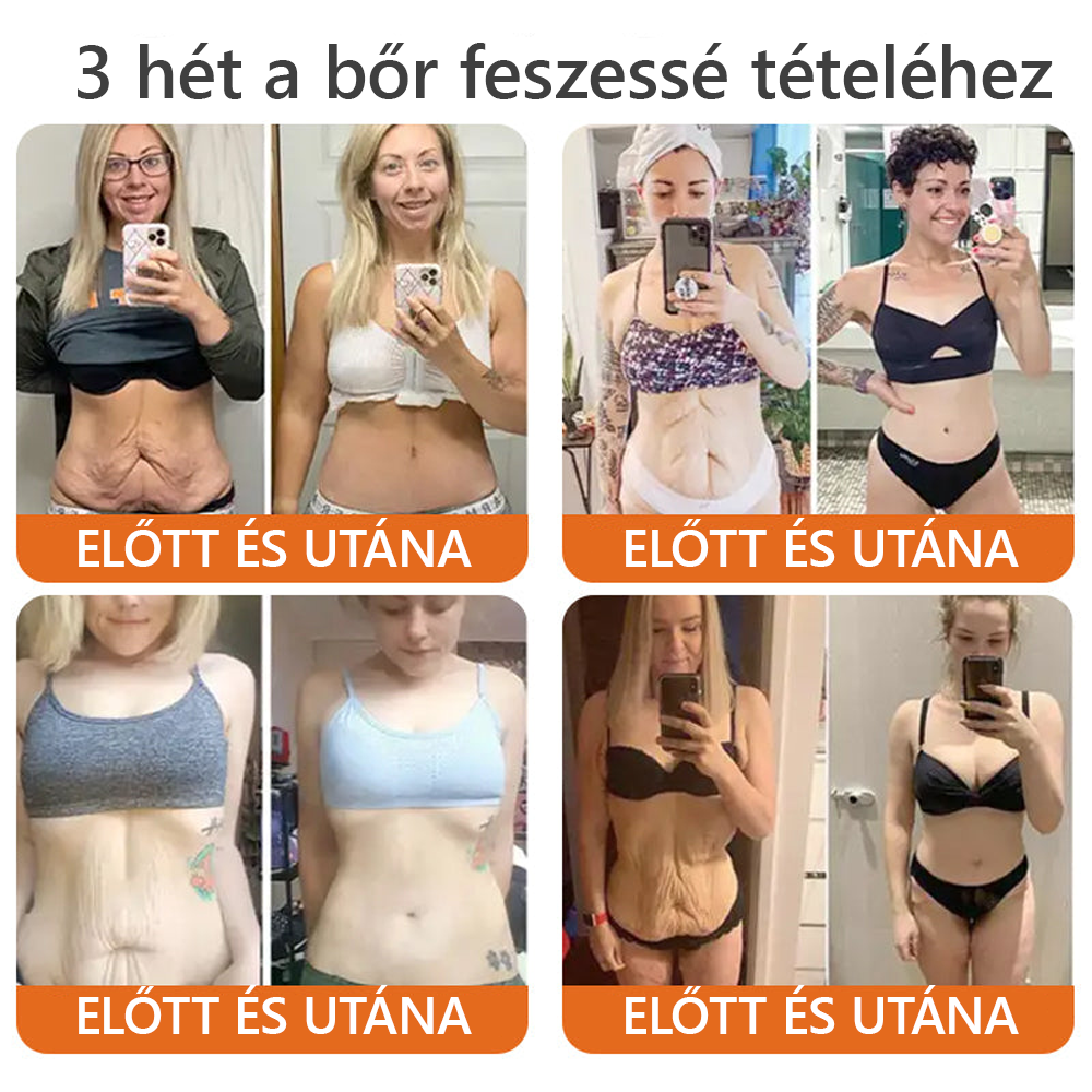 Magyarországról készült és szállított ✨𝐃𝐨𝐫𝐦𝐨𝐫𝐧𝐚® 𝐌é𝐡 𝐌é𝐫𝐞𝐠 𝐤𝐨𝐦𝐩𝐥𝐞𝐱 𝐤𝐫é𝐦 🔥 UTOLSÓ NAP 80% KEDVEZMÉNY💎💎