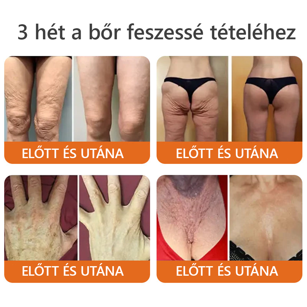 Magyarországról készült és szállított ✨𝐃𝐨𝐫𝐦𝐨𝐫𝐧𝐚® 𝐌é𝐡 𝐌é𝐫𝐞𝐠 𝐤𝐨𝐦𝐩𝐥𝐞𝐱 𝐤𝐫é𝐦 🔥 UTOLSÓ NAP 80% KEDVEZMÉNY💎💎