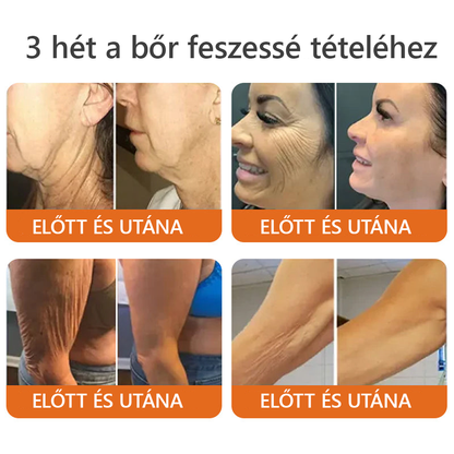 Magyarországról készült és szállított ✨𝐃𝐨𝐫𝐦𝐨𝐫𝐧𝐚® 𝐌é𝐡 𝐌é𝐫𝐞𝐠 𝐤𝐨𝐦𝐩𝐥𝐞𝐱 𝐤𝐫é𝐦 🔥 UTOLSÓ NAP 80% KEDVEZMÉNY💎💎