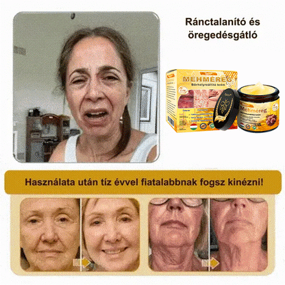 Spzv® bőrkezelő krém öregedésgátló, hidratáló, bőrjavító, egyenletes tónus, pattanások és sötét foltok kezelése, szemölcs és anyajegy eltávolítása, pikkelysömör enyhítése