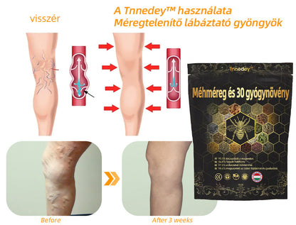 🚚📦Utolsó nap, hogy 70% KI: Tnnedey® 𝑴é𝒉𝒎é𝒓𝒆𝒈 é𝒔 30 𝒈𝒚ó𝒈𝒚𝒏ö𝒗é𝒏𝒚 𝒅𝒆𝒕𝒐𝒙 𝒍á𝒃𝒇ü𝒓𝒅ő 𝒈𝒚ö𝒏𝒈𝒚ö𝒌 𝒂 𝒕𝒆𝒔𝒕𝒇𝒐𝒓𝒎á𝒍á𝒔𝒉𝒐𝒛- Az Amerikai Nyirokgyógyászati Akadémia (ALA) ajánlása.